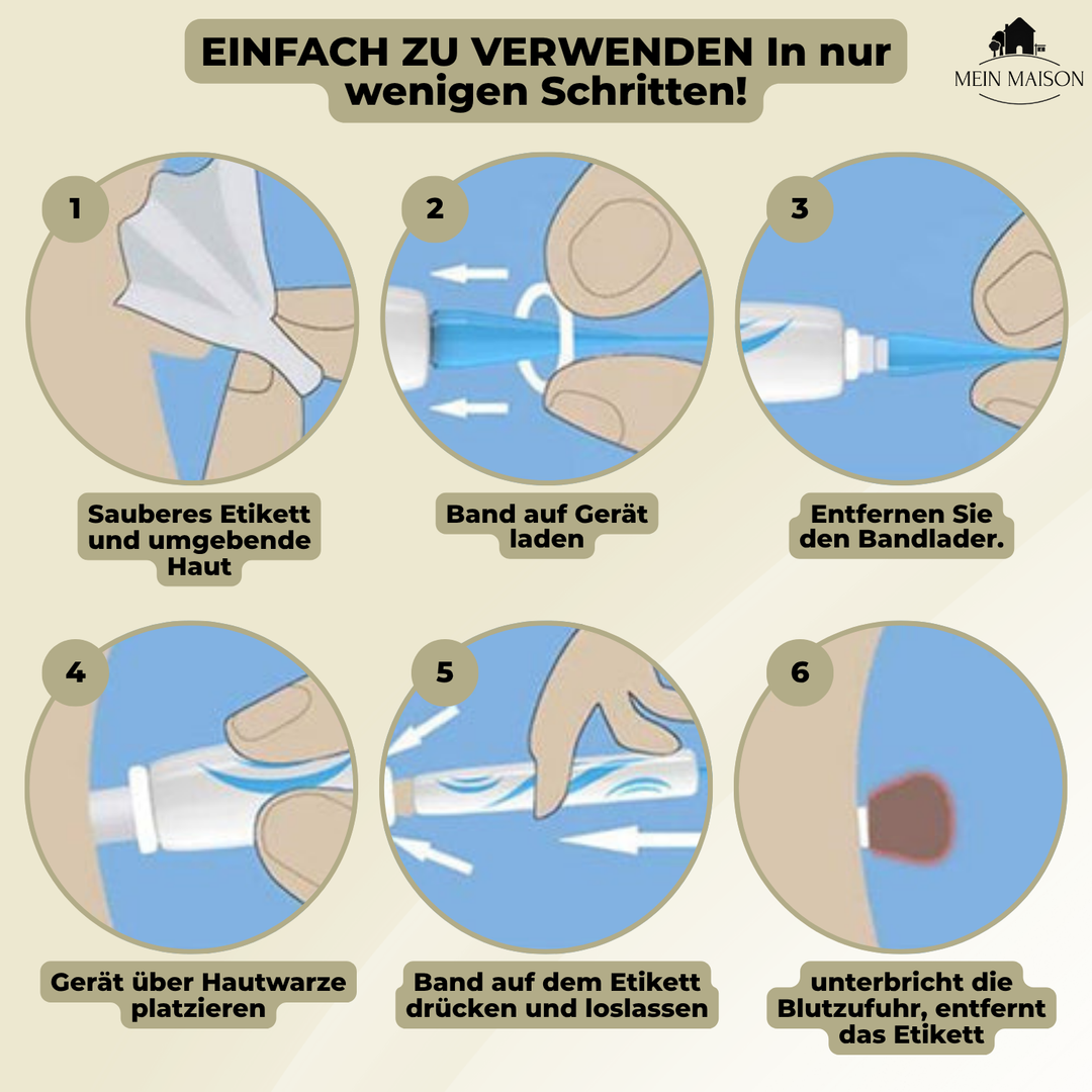 DermaLinx Vortefjerner | Smertefri fjerning av vorter og føflekker | Til hjemmebruk | Uten kirurgi