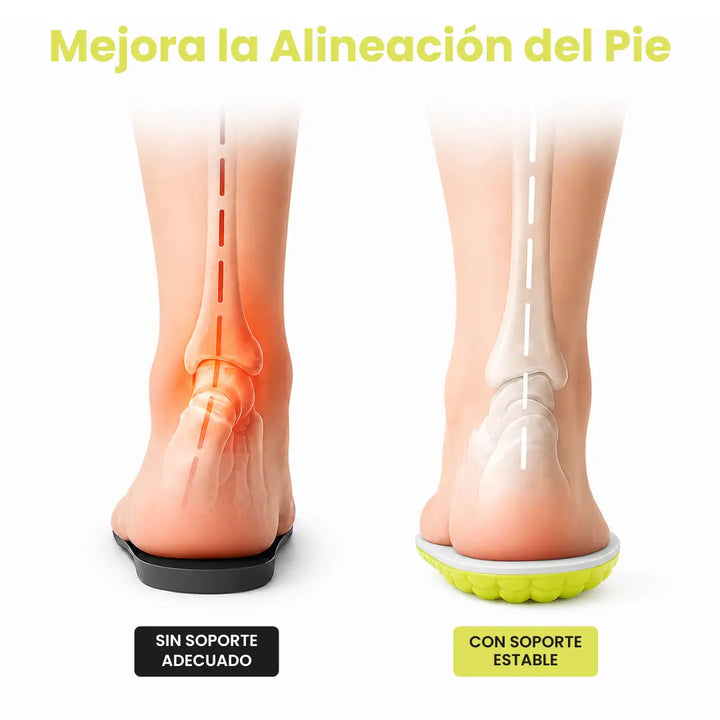 Ortopediske innlegg mot hælspore og plantar fasciitt