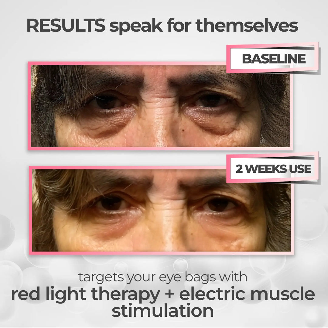 LumaNova Eye Rejuvenator for rødlysterapi og mikrostrøm