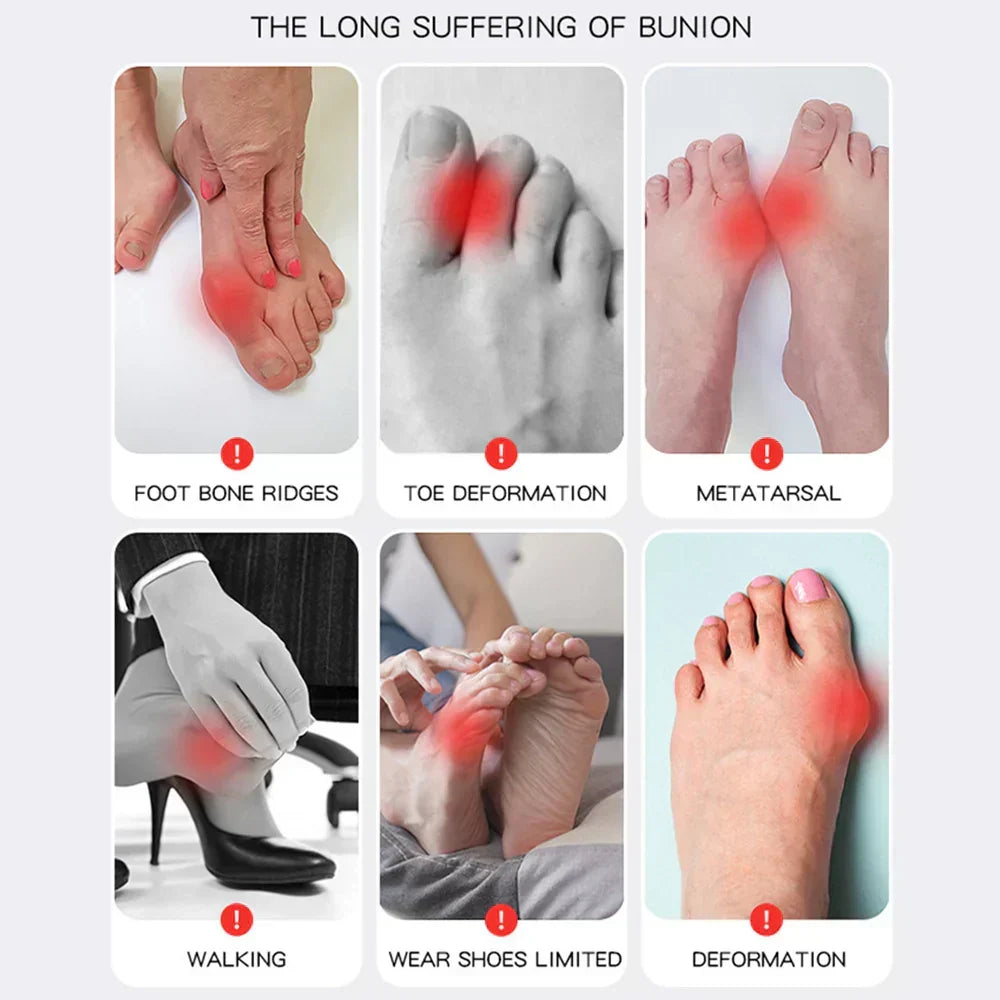 1+1 GRATIS | Hallux Valgus™ | Din komfortable løsning for smertefrie føtter!