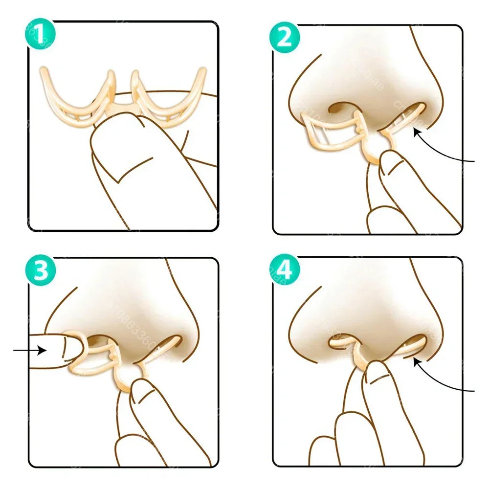Komfortabelt antisnorkeapparat – AirEase