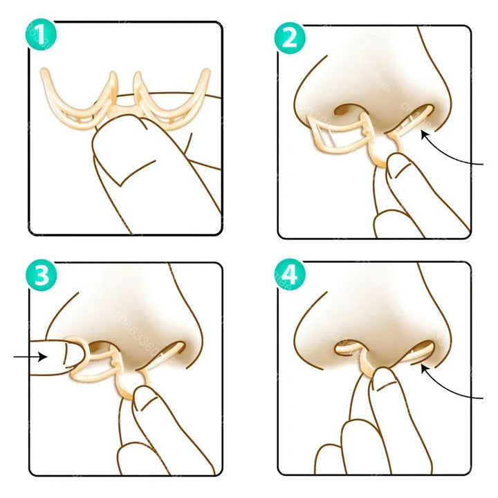 Komfortabelt antisnorkeapparat – AirEase