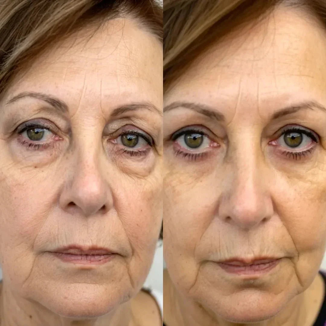 LumaNova Eye Rejuvenator for rødlysterapi og mikrostrøm