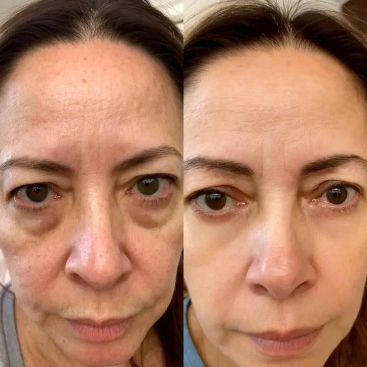LumaNova Eye Rejuvenator for rødlysterapi og mikrostrøm