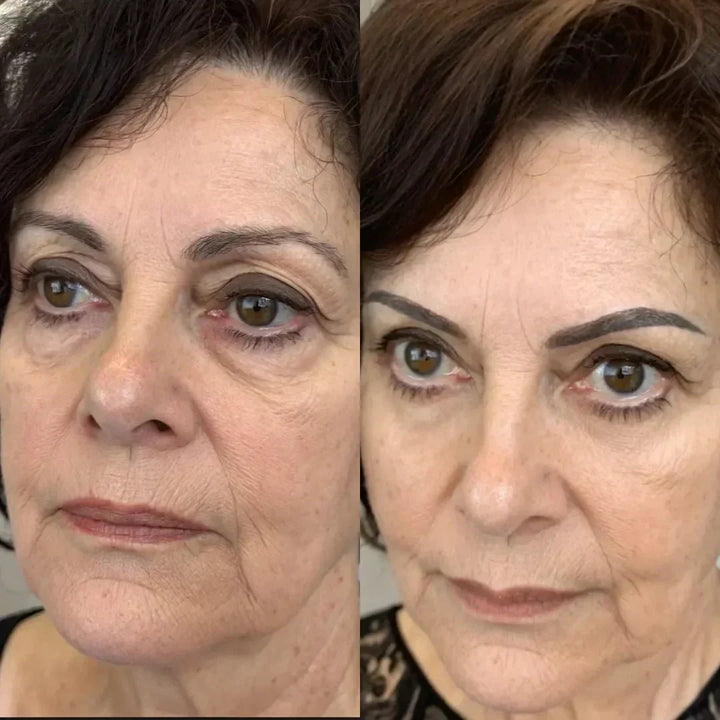 LumaNova Eye Rejuvenator for rødlysterapi og mikrostrøm